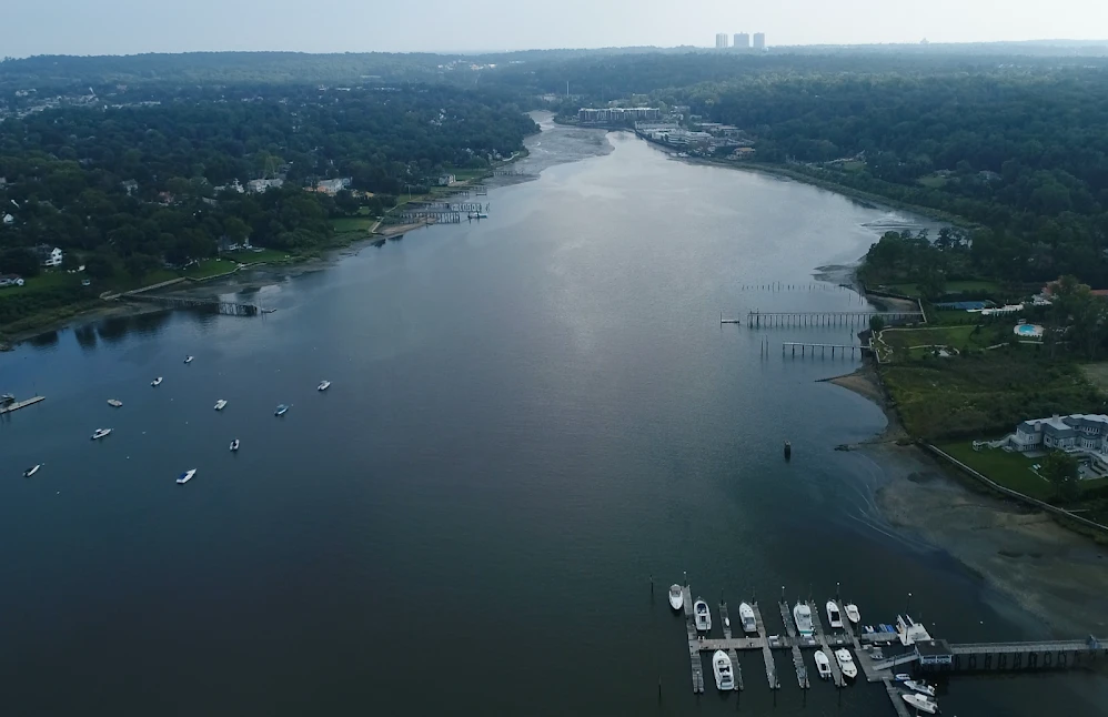 Expert Sleep Solutions In Port Washington, Ny | Vector Sleep Clinic 12 Manhasset bay -